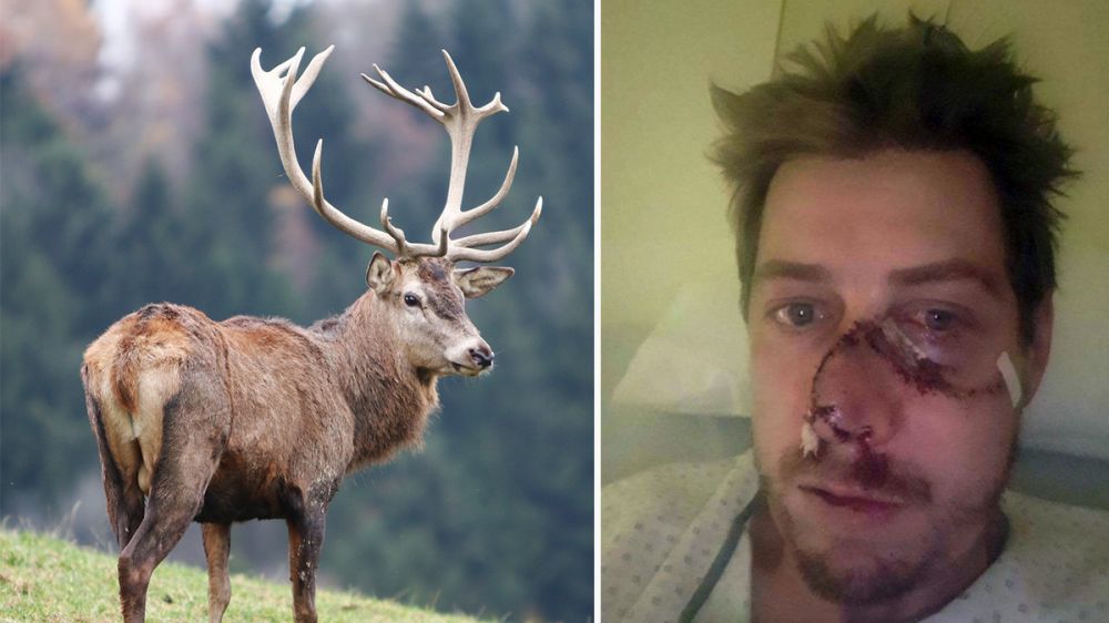Un ciervo ataca y le arranca la mitad de la cara a un cazador
